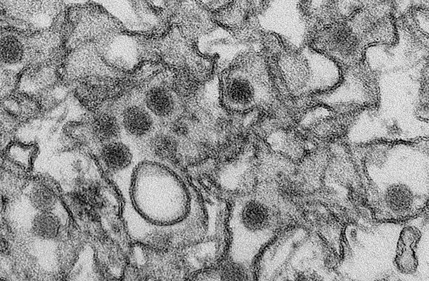 A vírus elektronmikroszkópos felvételen
