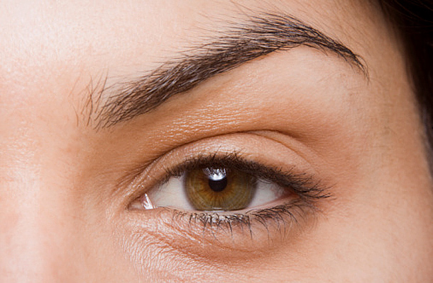 Duzzanat a szem alatt: a kezelés okai és a legjobb gyógymódok