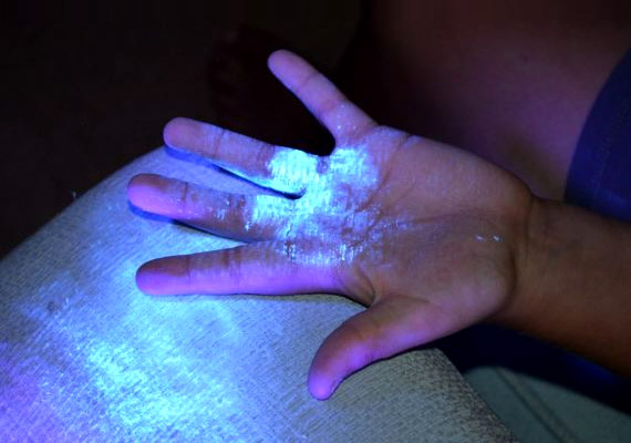 	Ha a kezedet UV-fény alá tartanád, valószínűleg téged is érnének meglepetések. Akár a fotel karfájáról is számos baktérium tapadhat rá.