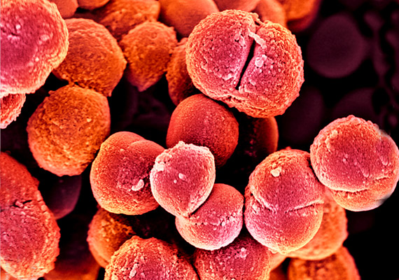 	A fenti képen látható Micrococcus baktériumok egyes fajtái gennykeltőek lehetnek, illetve a bakteriális hüvelyfertőzés kialakulásáért felelhetnek.