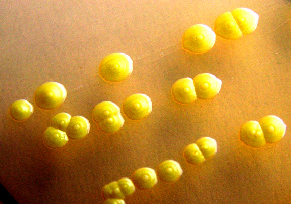 
                        	A Micrococcus luteus nevét sárga színéről kapta - a luteus latin szó, mely sárgát jelent. A baktérium előfordulása gyakori: elsősorban a vízben, a levegőben és a bőrfelületen tenyészik, nem kórokozó faj.
