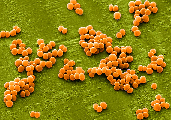 
                        	A Staphylococcus aureus normál körülmények között is megtalálható a bőrön, a köldökben vagy az orrnyálkahártyán. Potenciális kórokozóként ez felelhet a bőrgennyesedésért, az agyhártyagyulladásért és a vérmérgezésért.