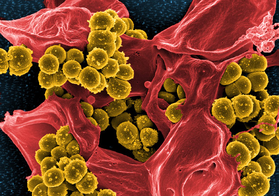 
                        	A Staphylococcus baktériumnemzetség mikroorganizmusai között akadnak gennykeltő baktériumok - például a képen látható Staphylococcus aureus -, de olyan mikroorganizmusok is, amelyek óvják a bőrt a negatív külső hatásoktól.