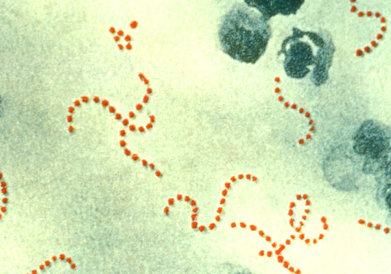 	A Streptococcus pyogenes - magyarul húsevő baktérium - előszeretettel szaporodik gyulladt bőrön, sebekben. Súlyos esetekben, illetve legyengült állapotban lévő betegeknél akár amputációhoz is vezethet.