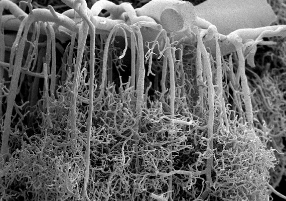 
                        	Akár egy fekete-fehér vízesés! Az elektronmikroszkóppal készült felvételen az agykéreg nagy ereit láthatod, melyek az egész kérget sűrűn behálózó hajszálerekbe továbbítják a vért.
