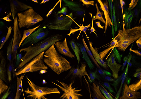 
                        	Akár egy modern festmény. A képen valójában emberi őssejteket - zöldre festve - láthatsz. A sejtmagokat kékkel, az asztrocitákat pedig sárgával jelölték.