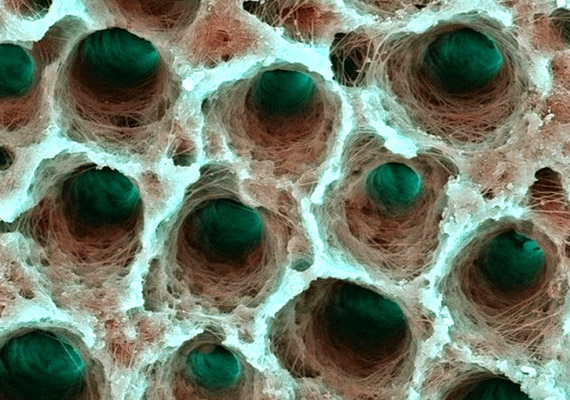 	A szuvasodást okozó baktériumok és más mikrobák munkáját egészen közelről mutatja a fenti kép.