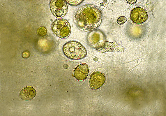 	A képen látható Coliform baktériumok önmagukban jellemzően nem okoznak betegséget, de jelenlétük azt mutatja, hogy más, ürülékből származó mikroorganizmusok is jelen lehetnek az adott helyszínen, amelyek emésztőrendszeri megbetegedésekhez vezethetnek.