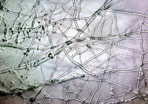 A mérget termelő mikroszkópikus gombák a növényi trágyában negatív hatással vannak a talajéletre