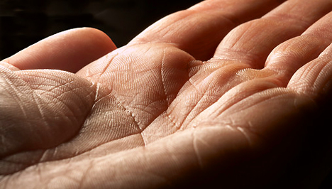 Súlyos betegségeket jelezhet a kézfejed: 9 árulkodó tünet, hogy baj van