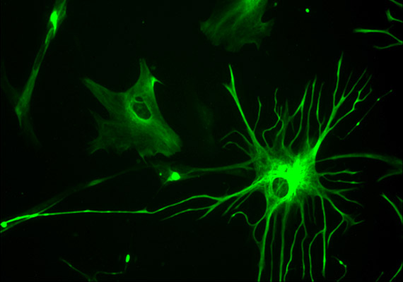 
                        	A képen egy 23 hetes magzat csillagsejtjei - asztrocitái - láthatók. Ezek a sejtek egyfajta ragasztóként funkcionálnak, melyek az idegsejteket tapasztják össze, de szerepet játszanak az alvás kiváltásában is.