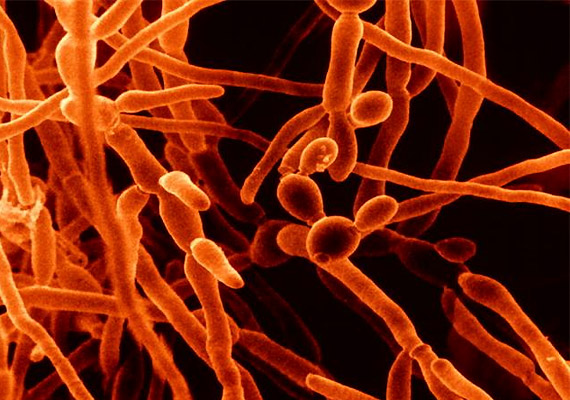 hogy néz ki a pinworms mikroszkóp alatt mérgező kábítószer- sorrend