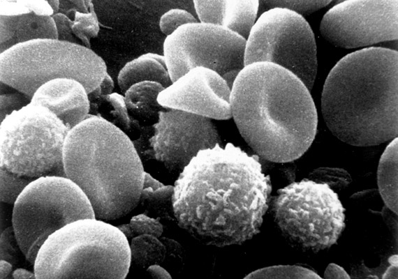 	Az elektronmikroszkópos képen az emberi vérben keringő vörösvérsejteket, fehérvérsejteket - beleértve a limfocitákat, monocitákat - és kis, korong alakú vérlemezkéket láthatsz.