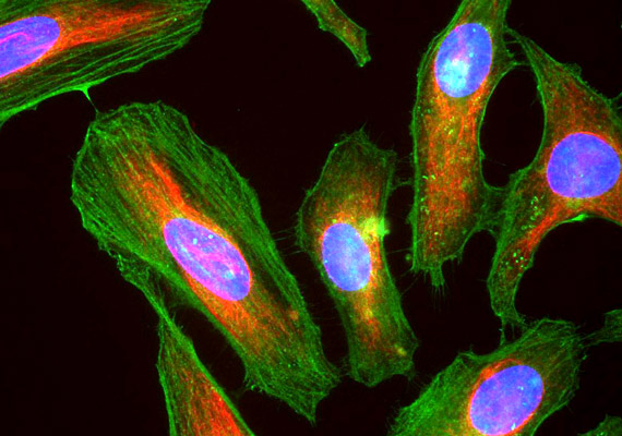 	A képen látható HeLa sejtek olyan tumoreredetű sejtek, melyeket 1951-ben a világon először sikerült laboratóriumi körülmények között előállítani és szaporítani. Használatuk azóta a biológiai kutatásokban általánossá vált.