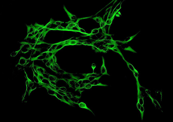 	A képen egymásba kapaszkodó neuronokat - idegsejteket - láthatsz ezerszeres nagyításban. A neuronok eredeti hossza 0,02-0,05 milliméter.