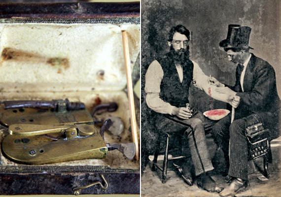 	A bal oldali képen egy a 19. század elejéről származó érvágókészletet láthatsz, míg az 1860 körül készült jobb oldali képen az eszköz használatát figyelheted meg. A módszer létjogosultságát abban látták a korabeli orvosok és felcserek, hogy az a beteg testnedvektől való megszabadulás a szervezet tisztulását, a gyógyulást segíti elő.