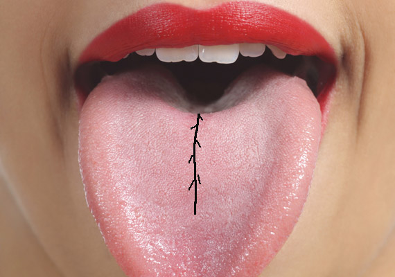 nyelv piercingjei segítenek a fogyásban