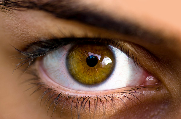Mi a teendő, ha egy barna pont jelenik meg a szemében? - Objektív 