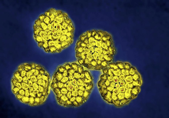 	A képen látható HPV - vagyis humán papilloma vírus - egyes alfajai okozzák a bőrön kialakuló szemölcsöket, míg mások a méhnyakrákért felelnek. Tudod, hány éves korig érdemes kérned a HPV elleni oltást?