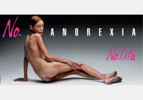 	Az Isabelle Caro francia modell-színésznőről készült megrázó plakátok bejárták a világot. Valójában Oliviero Toscani róla készített No Anorexia reklámkampányának köszönhetően lett világhírű. 2010-ben azonban elhunyt egy, az alultápláltság következtében rajta elhatalmasodó fertőzés miatt.