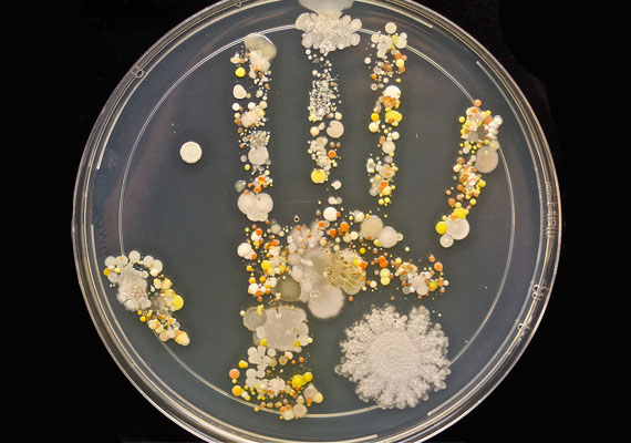 	A Petri-csészében, amelybe a zselébe nyomott kézlenyomat került, jól kirajzolódott, hogy a gyerek kezéről származó baktériumok szaporodásnak indultak, és kolóniákat alkottak.