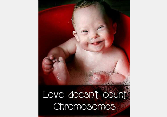 	A szeretet nem számolja a kromoszómákat.