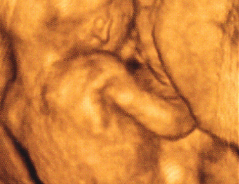 Az embrió egyre jobban érzékeli a külvilágot (Fotó: Pocakosnapló)