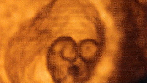 Alakul a baba teste, megjelennek a végtagbimbók (Fotó: Pocakosnapló)