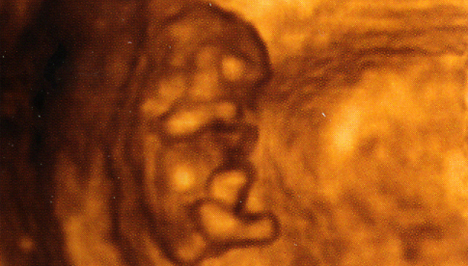 Az embrió babaszerű alakot kezd ölteni (Fotó: Pocakosnapló)
