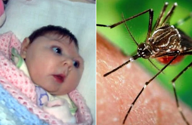 zika vírus fogyás