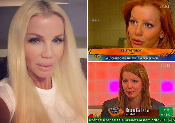 	A 41 éves Keleti Györgyi, egykori modell arcán az ajakfeltöltés a legszembetűnőbb, de nem ez az egyetlen változás a jobb oldali, 2007-es tévéfelvételekhez képest.