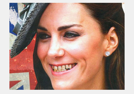 	A The New Republic című amerikai magazin 2012. júliusi 12-i számának címlapján Katalin hercegnét boszorkánnyá változatva, nem túl esztétikus fogsorral ábrázolják - mint Nagy-Britannia sötét időinek szimbólumát. 