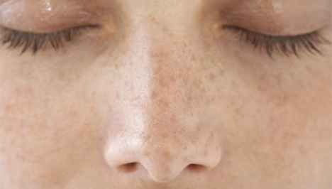 Amit a bőr öregedéséről tudni kell