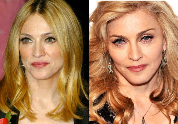 	Madonna megszállottan ragaszkodik a fiatalsághoz, nevetséges öltözékekben jelenik meg, tiniknek való dolgokat visel. Természetesen a bőrére is figyel egy plasztikai sebész.