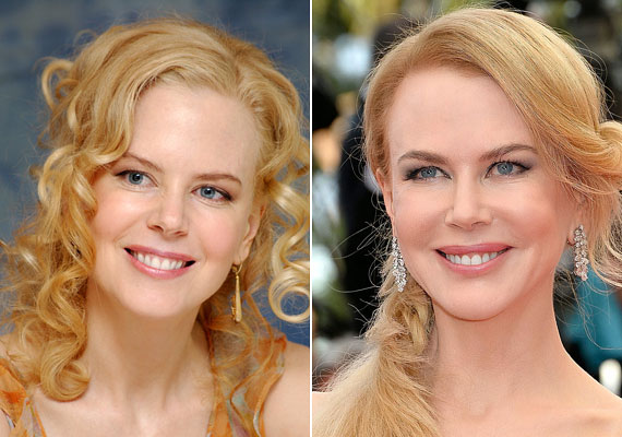 	A botox egy idő után Nicole Kidman munkáját veszélyeztette, mert senki nem akart a merev arcú színésznővel dolgozni. Azóta átváltott valami másra, mert továbbra sem ráncosodik, viszont az arca már mozog, ezért ismét vannak szerepei.