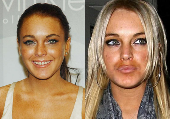 
                        	Lindsay Lohannek sikerült egy kis bajuszt magára barnítani, vagy egyszerűen csak nagyon természetellenesre színeztetnie magát.