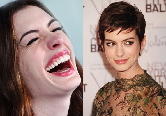 
                        	Anne Hathaway arcának oldalán szaporodtak el a pattanások, mára megszabadult tőlük, vagy nagyon jó a sminkese.