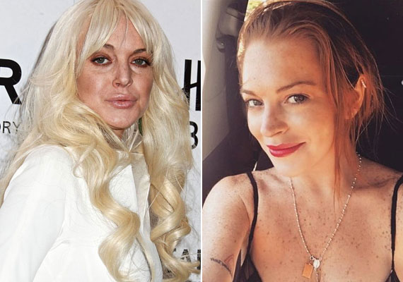 
                        	Lindsay Lohan még nincs 30 éves. Alkohol- és drogfüggősége a külsejére is hatással volt, ezt próbálta plasztikával kompenzálni, de bár ne tette volna. Szerencsére ma egészségesnek és boldognak tűnik.