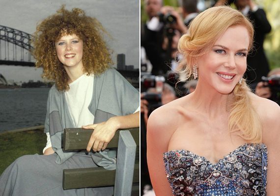 	Nicole Kidman változott a legtöbbet önmagához képest. A hajdani rút kiskacsa szépséges hattyúvá lett, bár az utóbbi időben mértéktelenné vált a plasztikaimádata. Egy biztos, a fiatal Nicole és a mai Nicole mintha két különböző ember lenne.