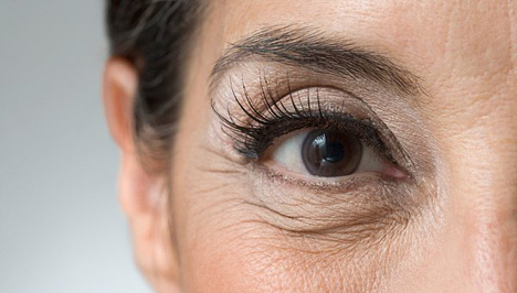 a rossz látás ráncai hogyan lehetne javítani a látáskorlátozás módszerét