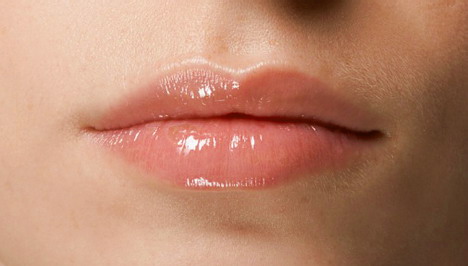 Piros pöttyök a száj körül, milyen krém segíthet? - Bőrbetegségek