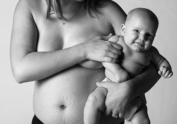 	Jade Beall fotósorozatán a szülés utáni női test látható. Nem, nincs lapos has, nincs bababőr, de miért is kellene eltitkolni, hogy a gyermekvállalás bizony nyomot hagy?