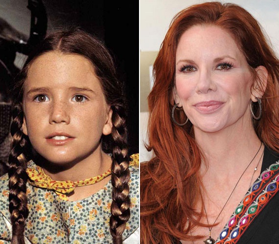 	Melissa Gilbert a plasztikáztatást is túlzásba vitte, aminek köszönhetően arcvonásai 52 éves korára jelentősen megváltoztak.